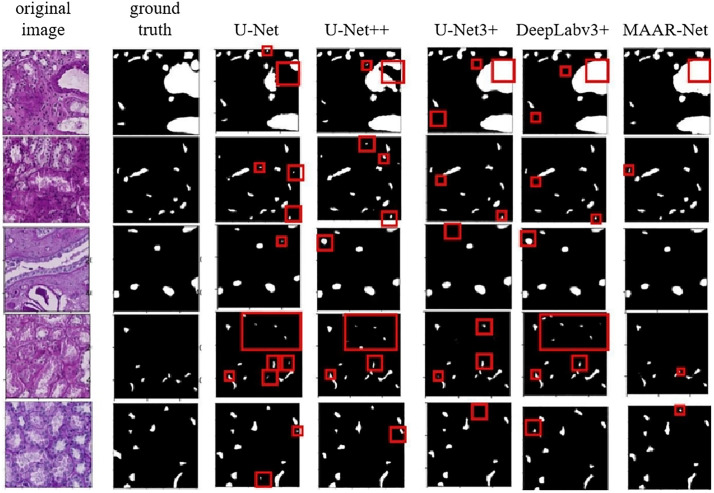 Fig 11