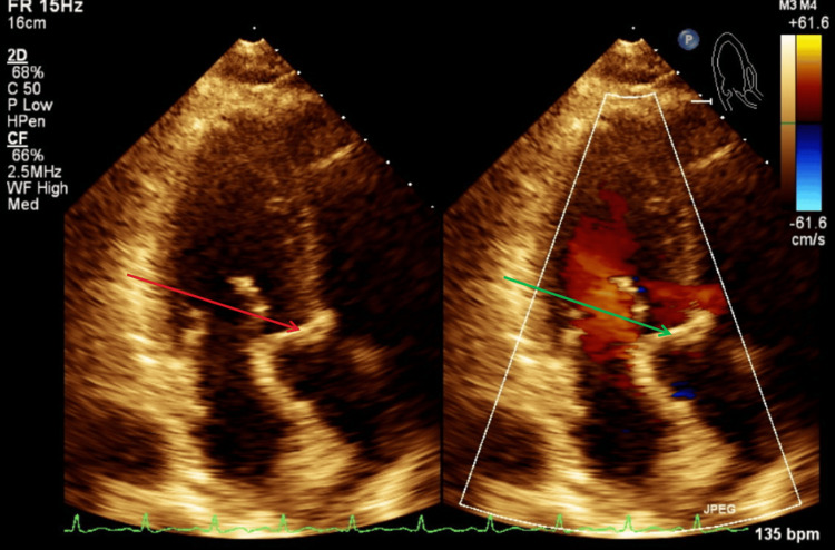 Figure 10