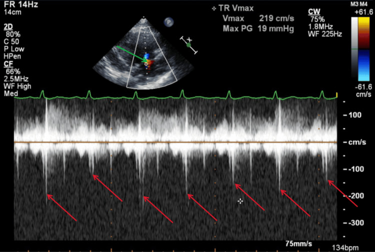 Figure 11