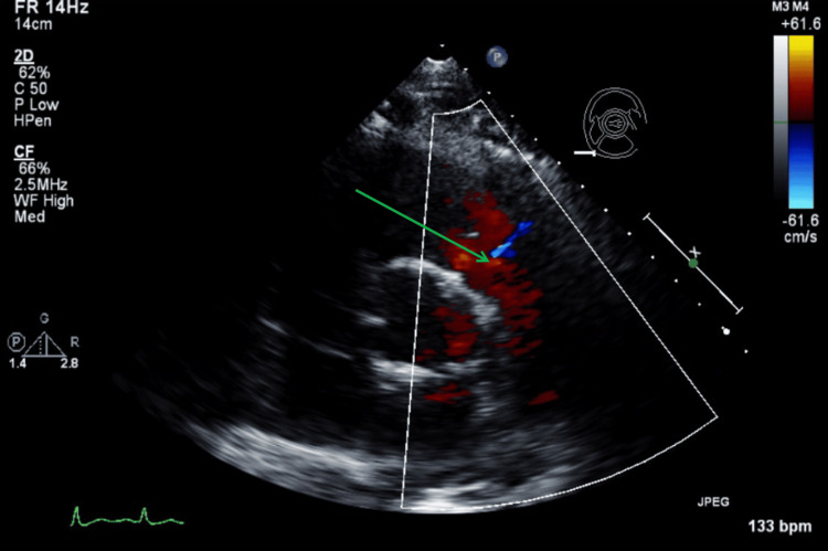 Figure 12