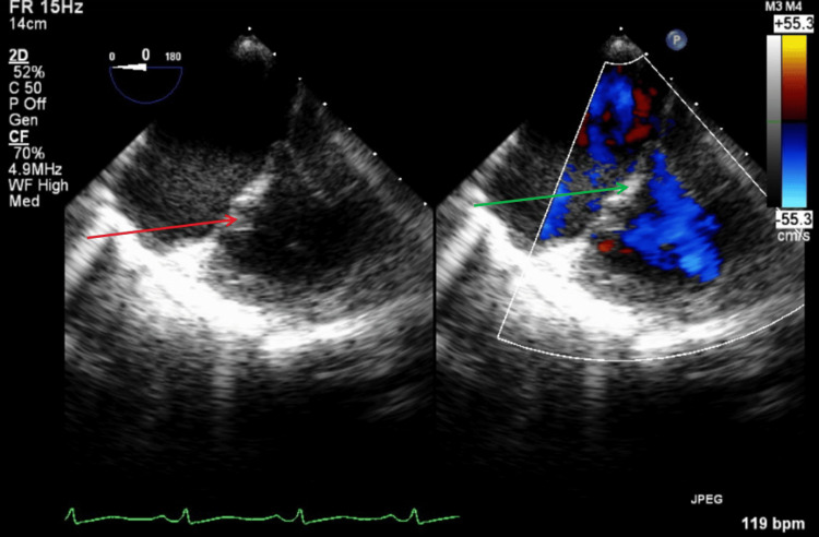 Figure 13