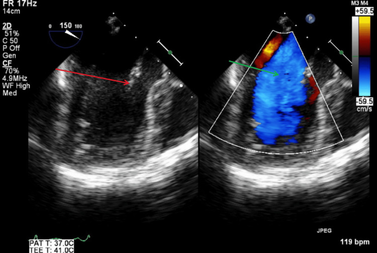 Figure 14