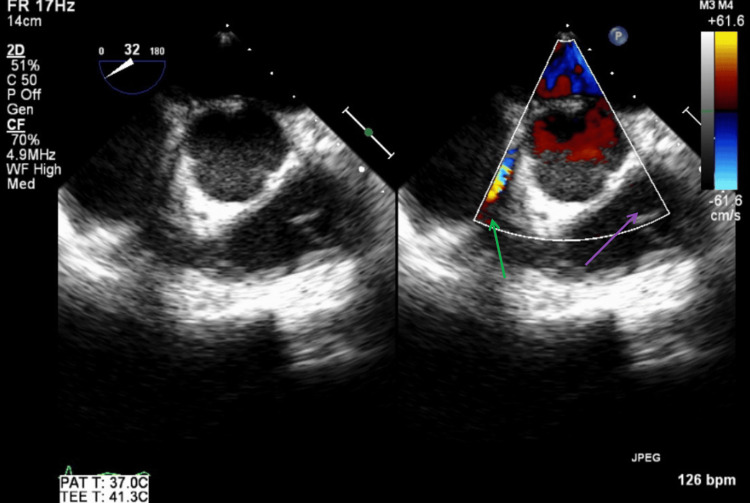 Figure 15