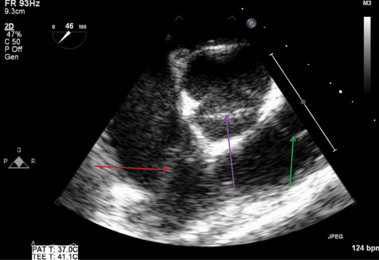Figure 16