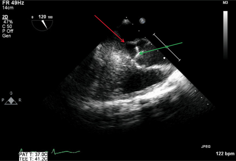 Figure 17