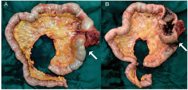 Figure 3