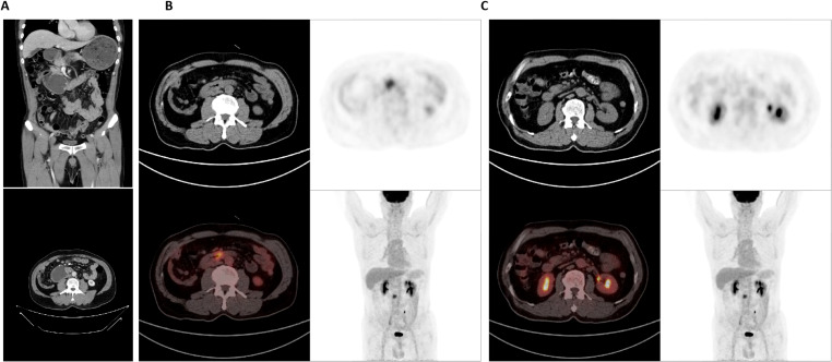 Figure 1