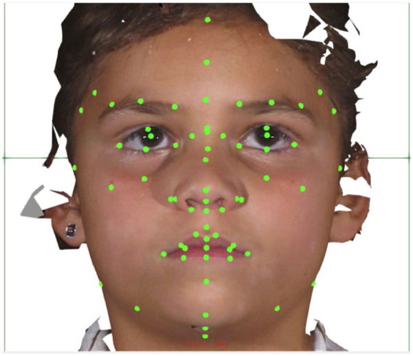 Figure 3