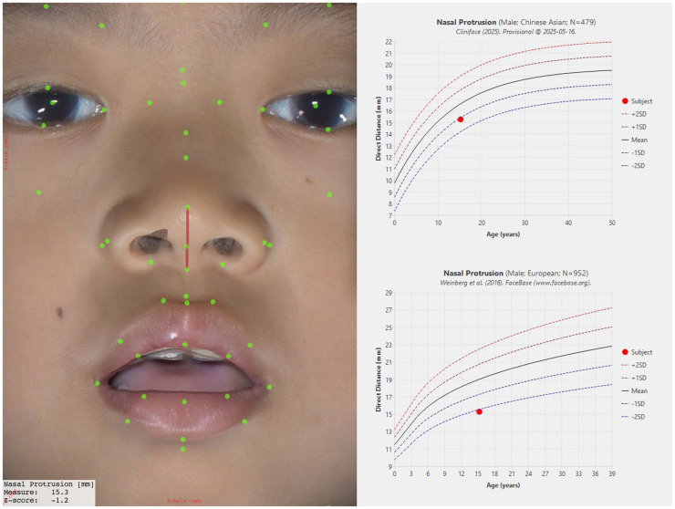 Figure 13