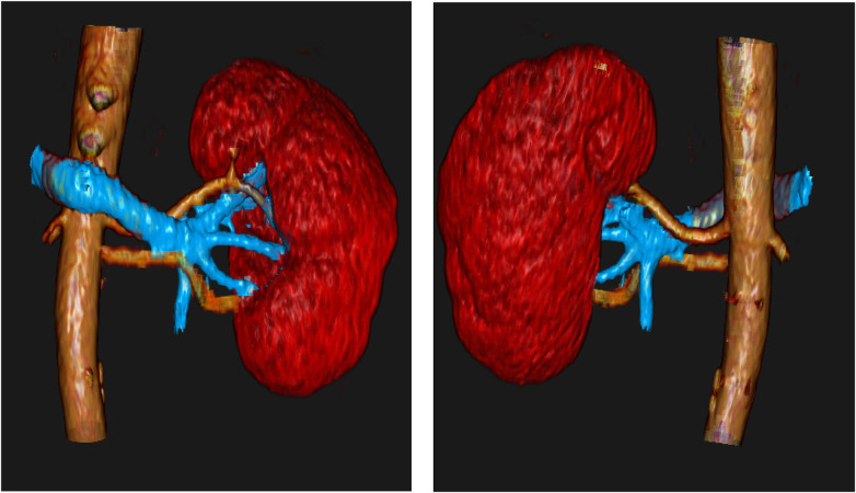Figure 2