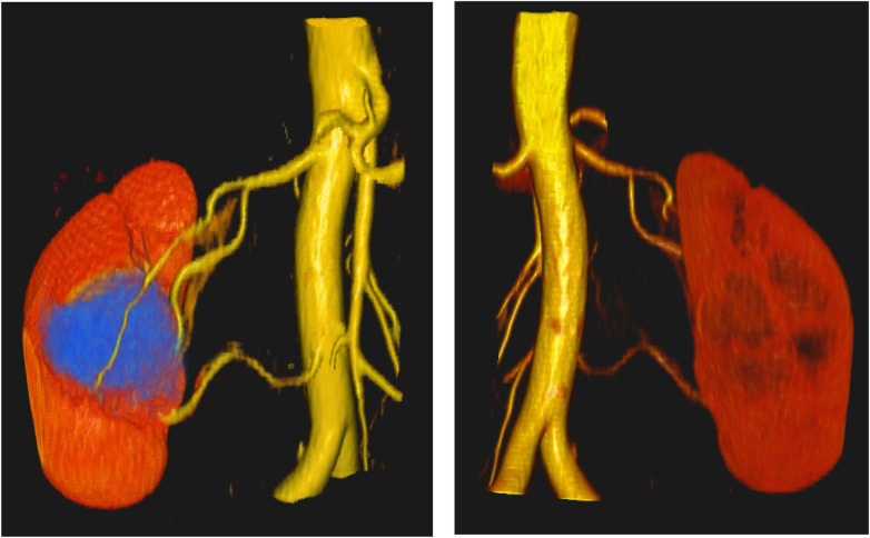 Figure 3