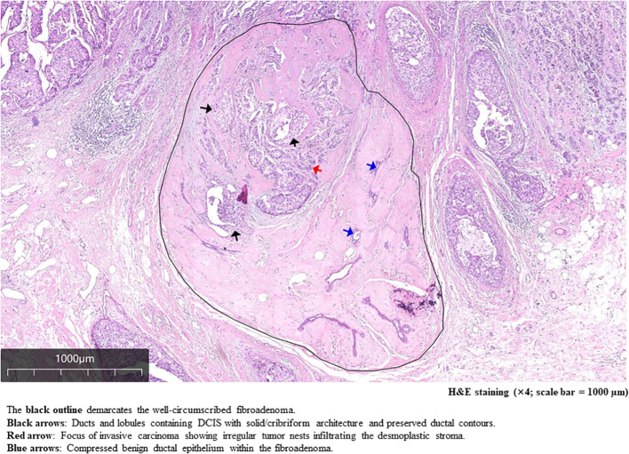 Figure 4