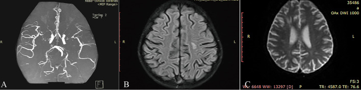 Figure 2