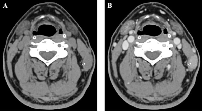 Figure 1