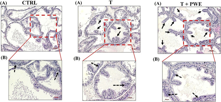 FIGURE 3
