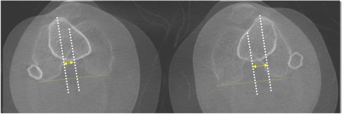 Figure 2