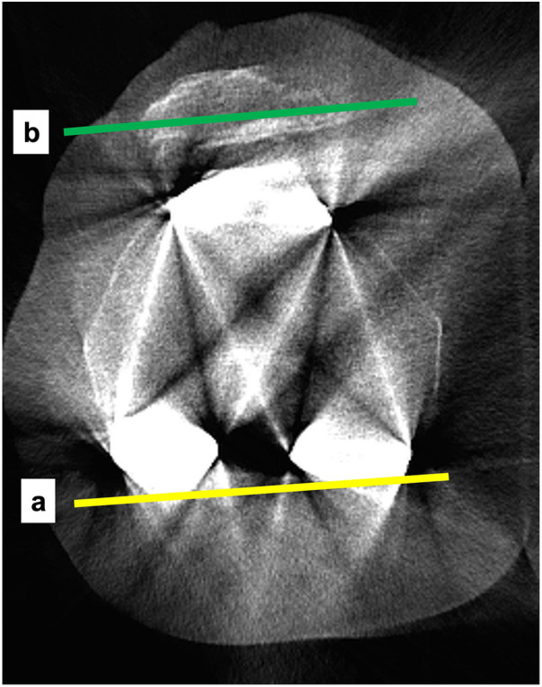 Figure 11