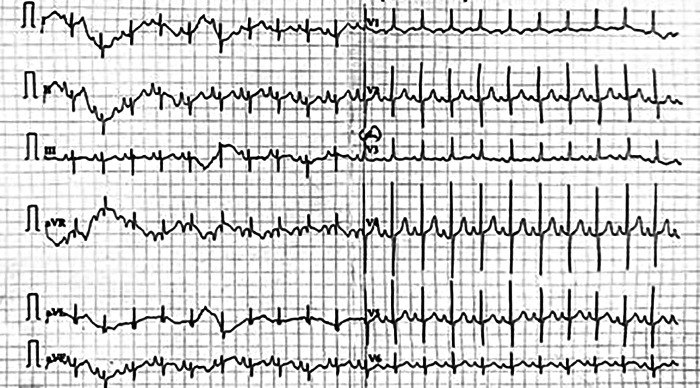 Figure 1