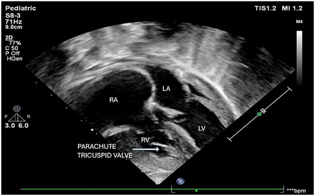 Figure 3
