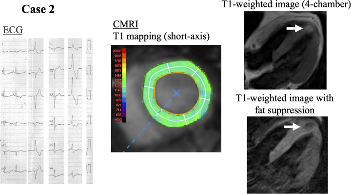Figure 3