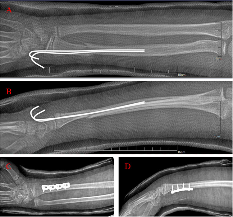 Figure 1
