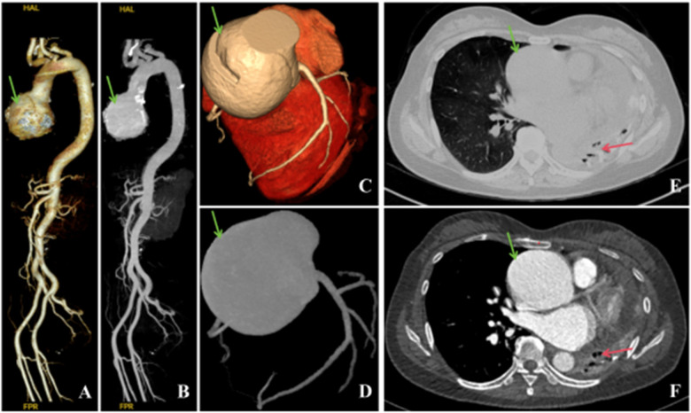 Figure 1