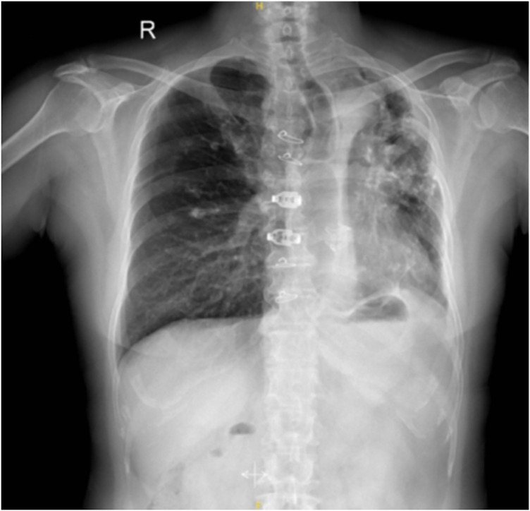 Figure 3