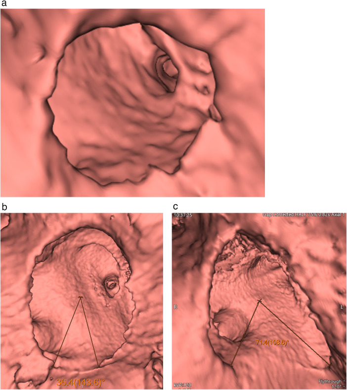 Figure 2