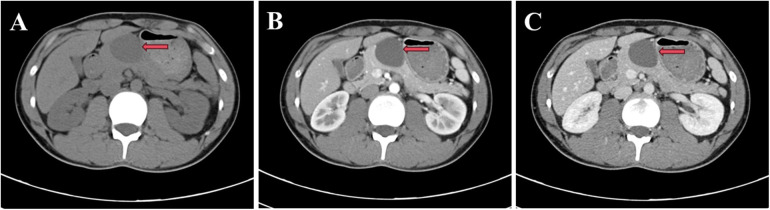 Figure 1
