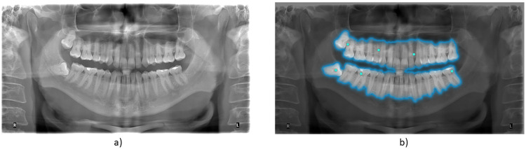 Figure 1