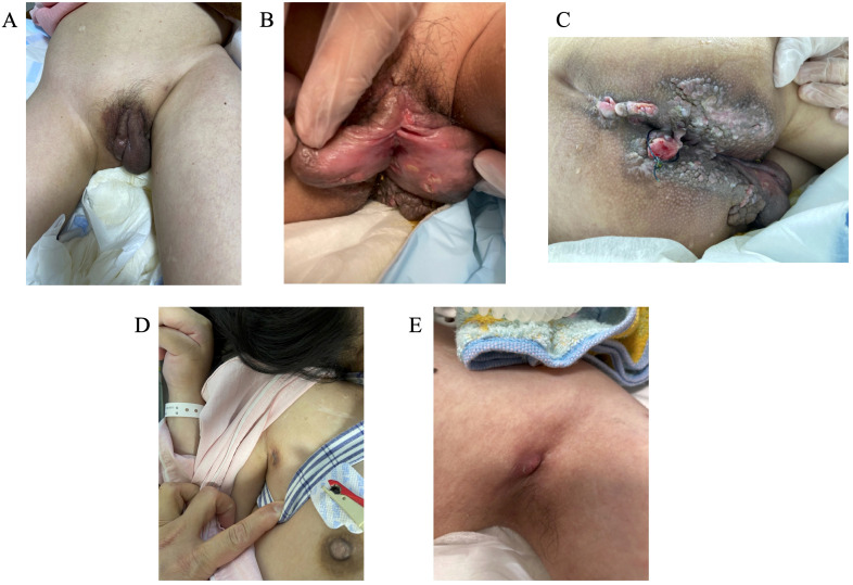 Figure 1