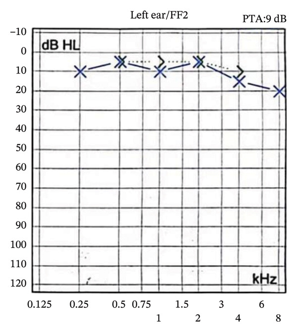 Figure 4