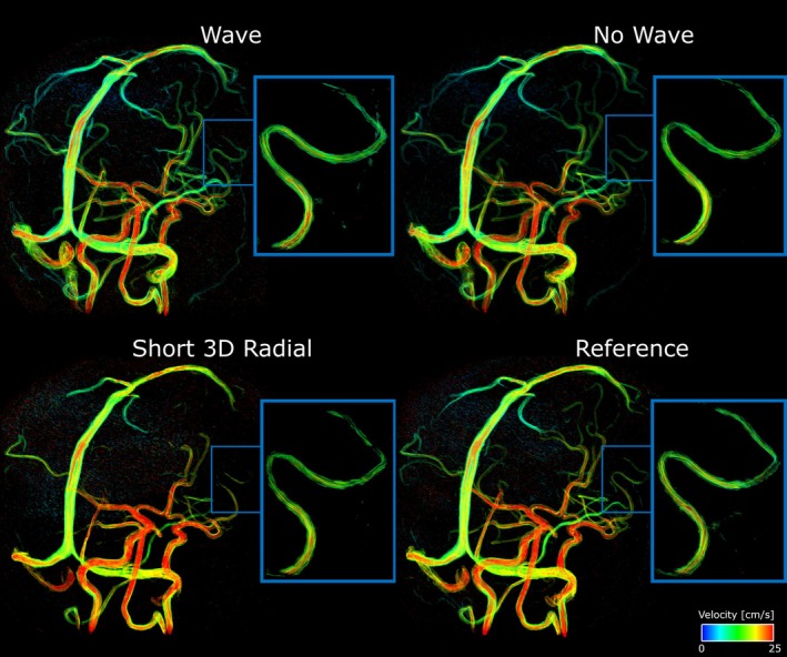 Figure 9