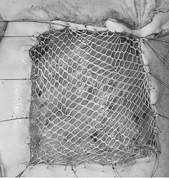 Fig. 4