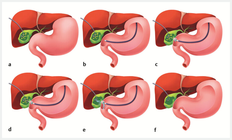 Fig. 5