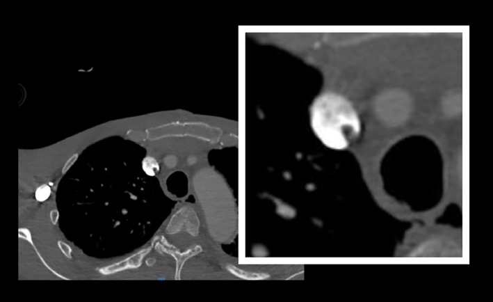 FIGURE 3