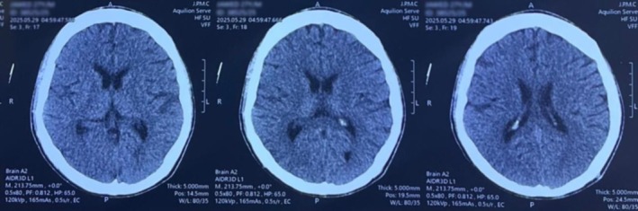 FIGURE 1