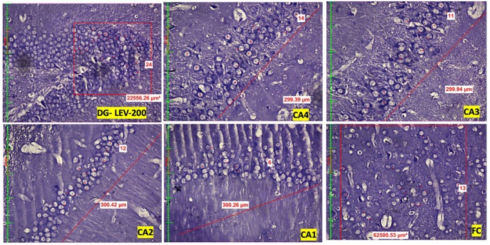FIGURE 2