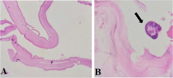 FIGURE 3