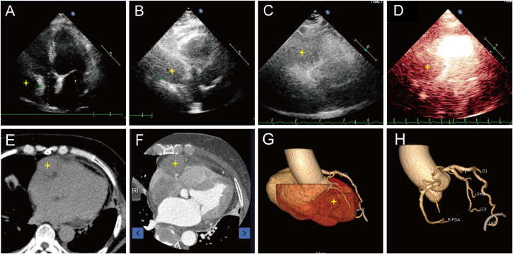 Figure 1