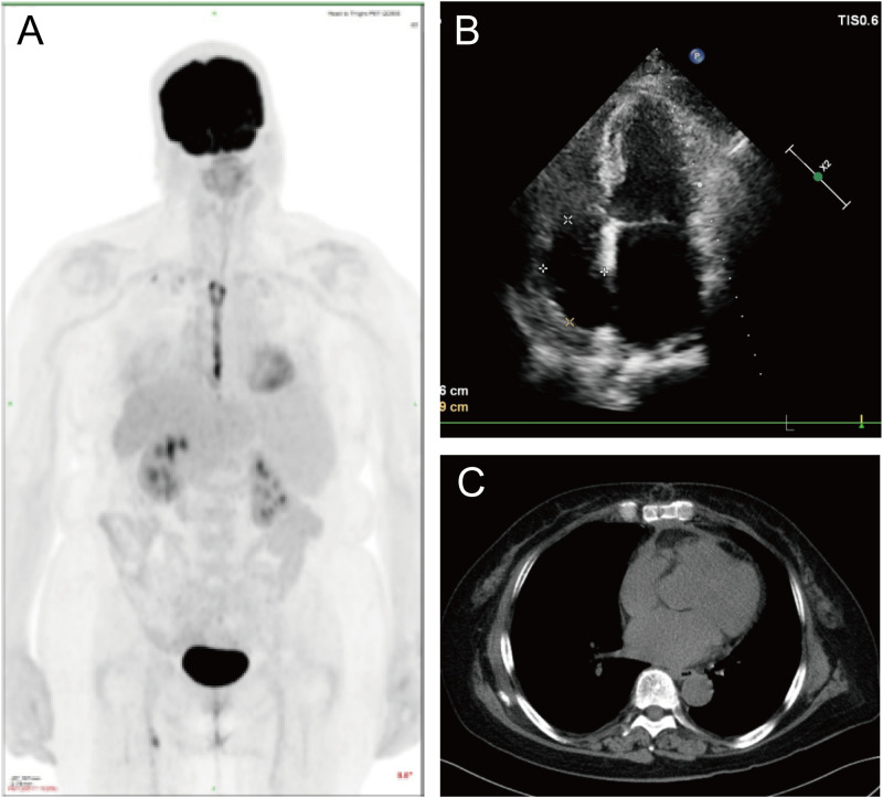Figure 4