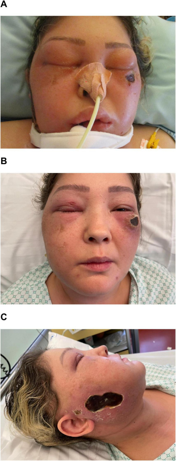 FIGURE 1