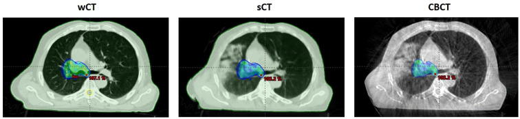 Figure 3