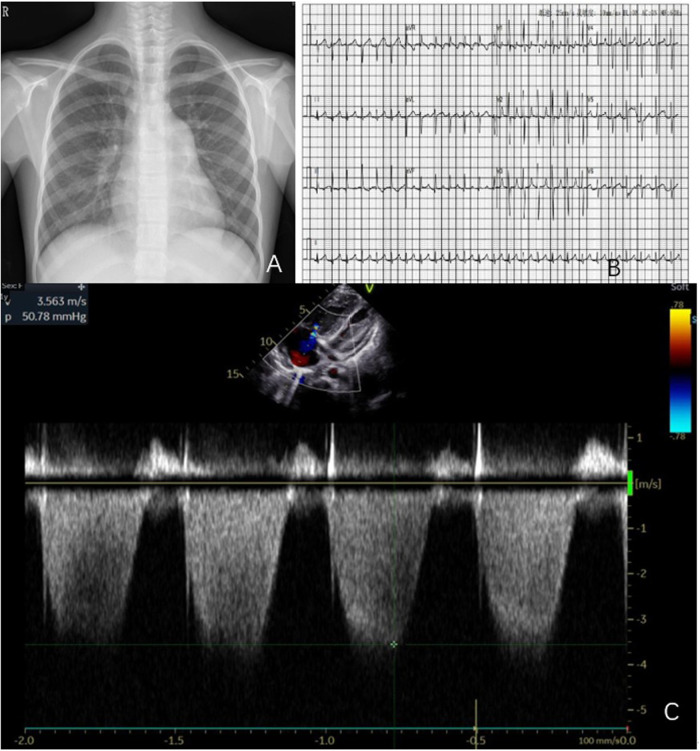 Figure 1