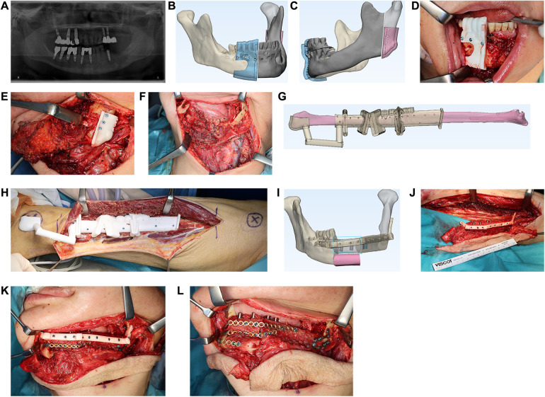 Figure 1