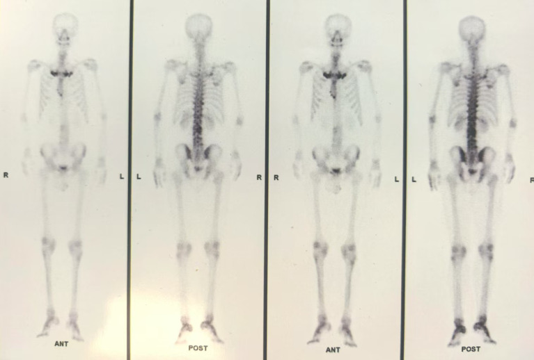 Figure 2