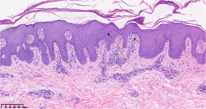 Figure 3