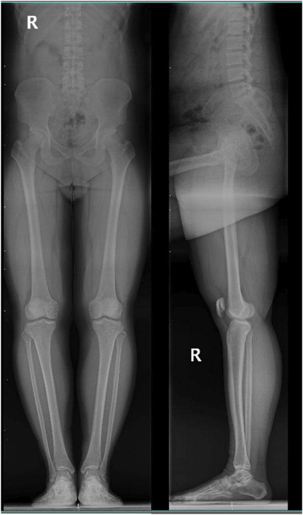 FIGURE 1