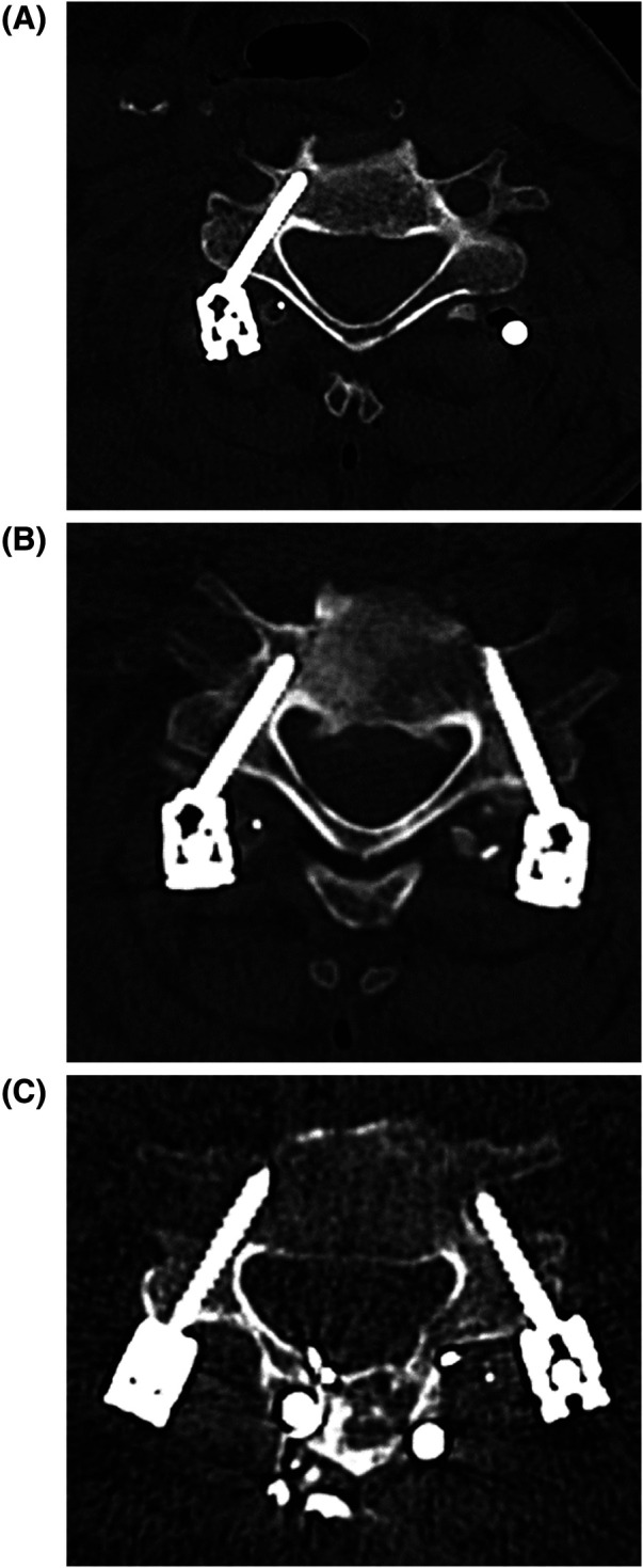 Figure 2