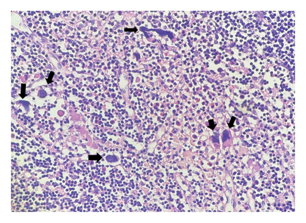 FIGURE 3